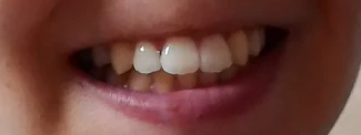 teeths.png